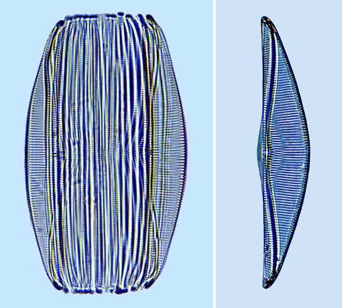 Amphora Amphora securicula